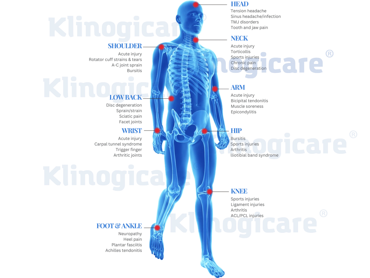 Anatomical atlas showing the main areas of HILT application: spine, large joints, peripheral nervous system, muscles, fascia, ligaments, and tendons