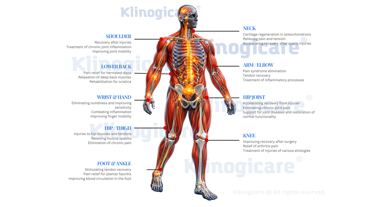 Anatomical atlas showing the main therapeutic application zones of Quantum Magnetic Storm on the spine, joints, peripheral regions, large muscle groups, and pelvic floor