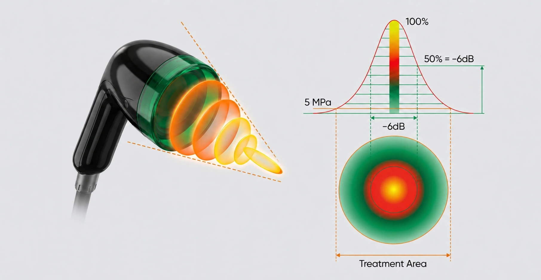 Concept of a focused shockwave applicator delivering targeted energy to deep anatomical structures